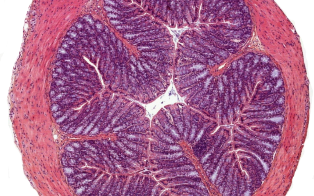 Toxoplasma gondii chronic infection decreases visceral nociception through peripheral opioid receptor signaling